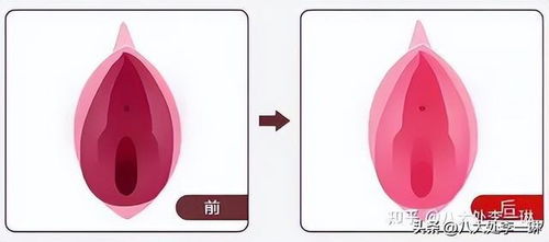 私密处颜色与性经验：真相揭秘，打破传统误解 2