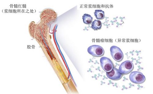 想知道'骨髓'的正确拼音吗？一秒钟带你揭晓答案！ 3