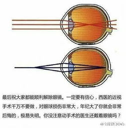 近视治疗的有效方法有哪些 1