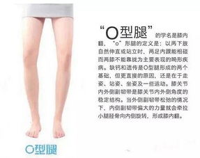 如何矫正O型腿的方法有哪些？ 1