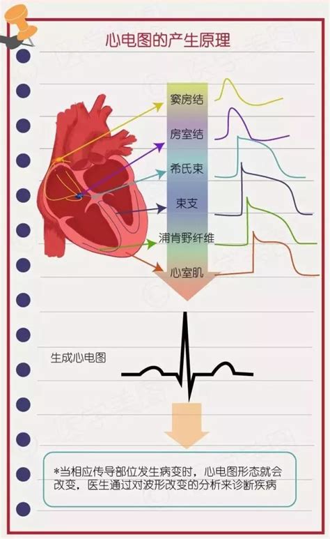 揭秘心电图：一读就懂的实用指南 2