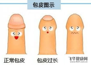 男性生殖器官正常尺寸范围是多少 2