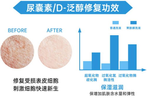 高效解决女性私密异味：六大实用方法 2