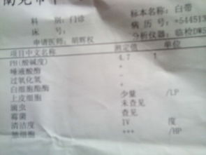阴道里为什么会流出白色的东西？ 1